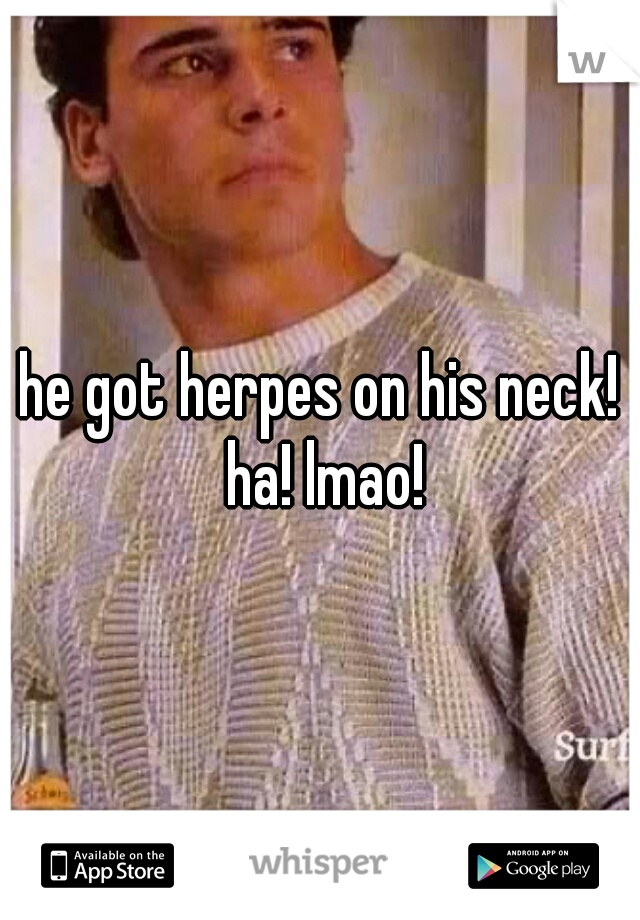 he got herpes on his neck! ha! lmao!