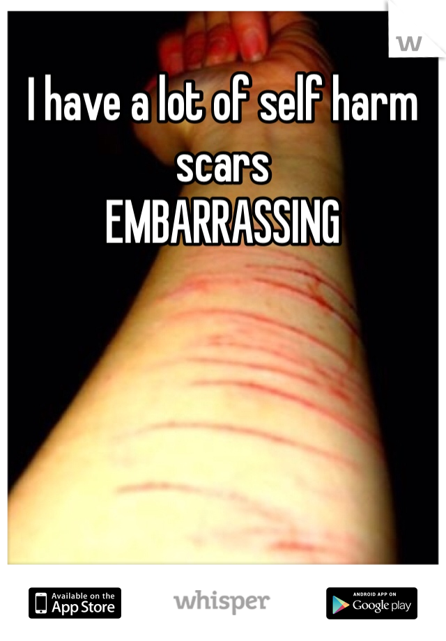 I have a lot of self harm scars 
EMBARRASSING 