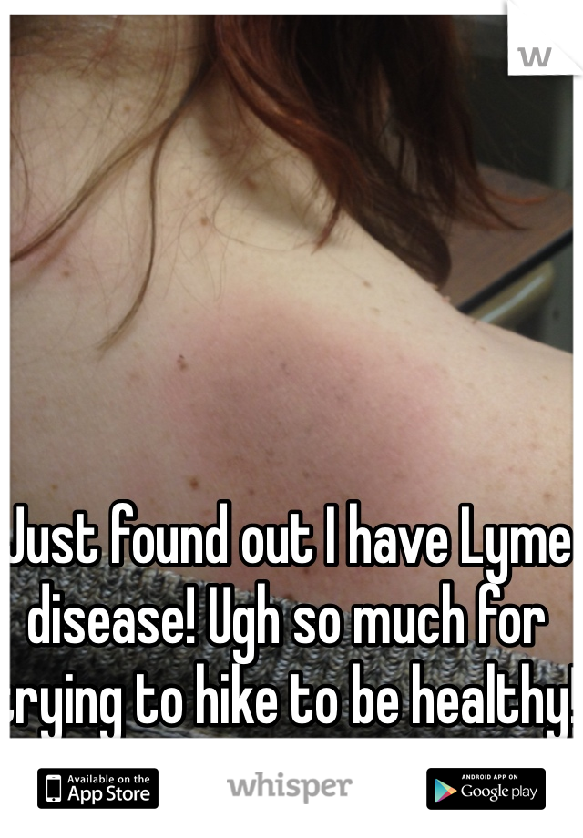 Just found out I have Lyme disease! Ugh so much for trying to hike to be healthy! 