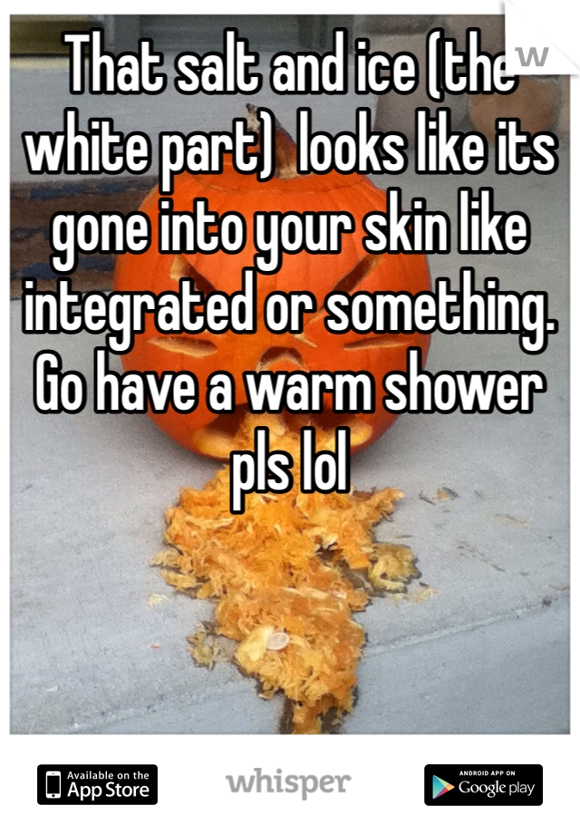 That salt and ice (the white part)  looks like its gone into your skin like integrated or something. Go have a warm shower pls lol