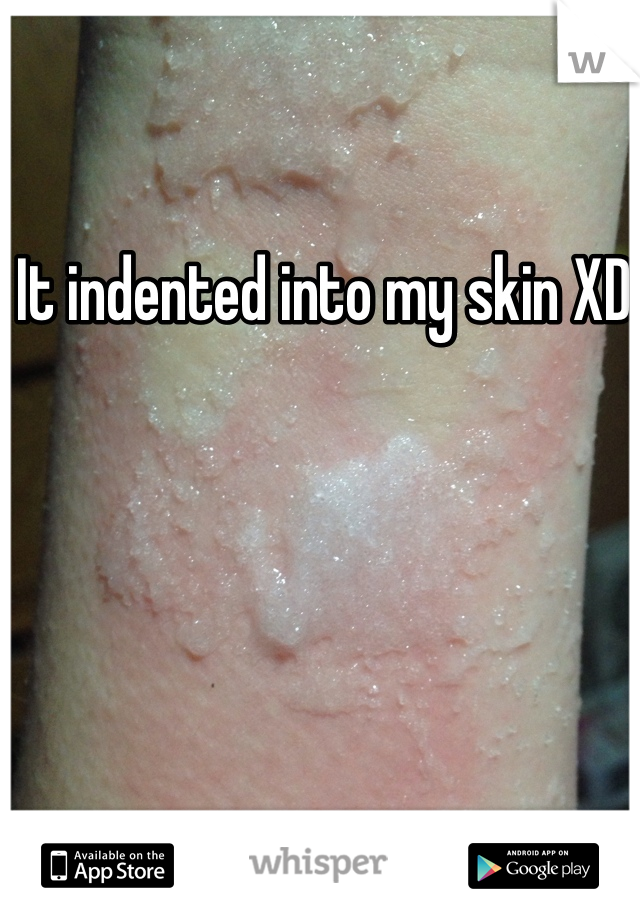 It indented into my skin XD 
