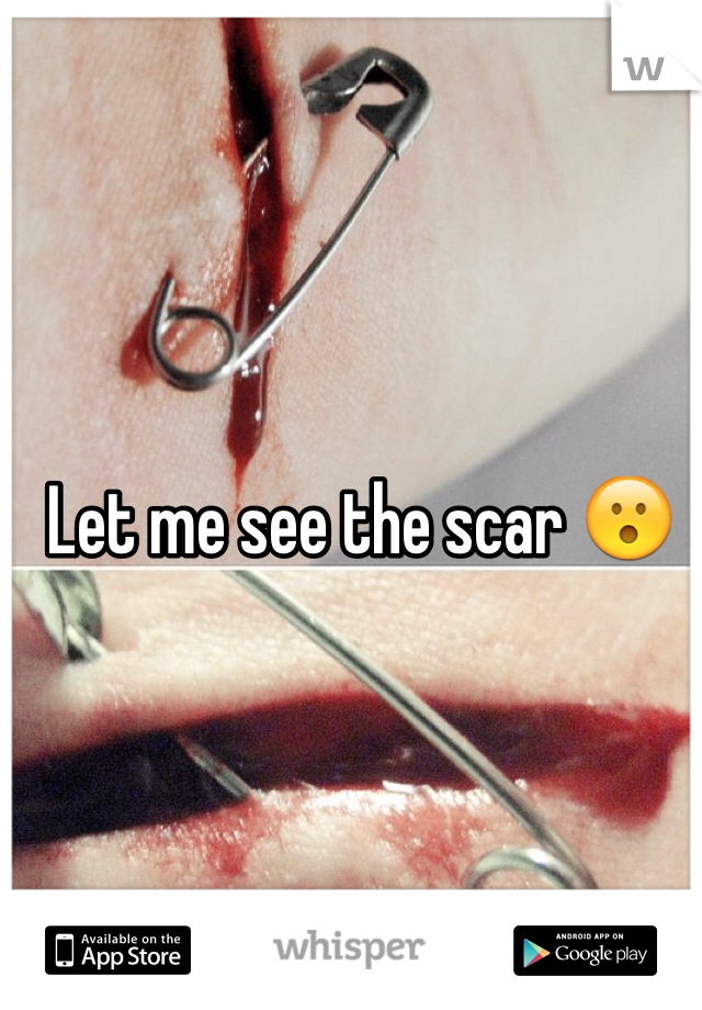 Let me see the scar 😮