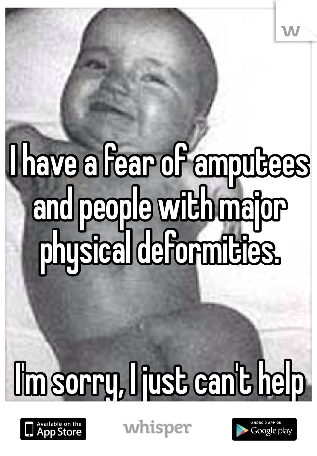 I have a fear of amputees and people with major physical deformities. 


I'm sorry, I just can't help it. 