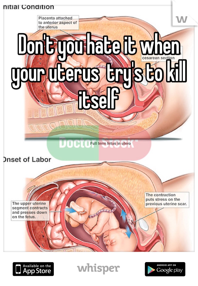 Don't you hate it when your uterus  try's to kill itself