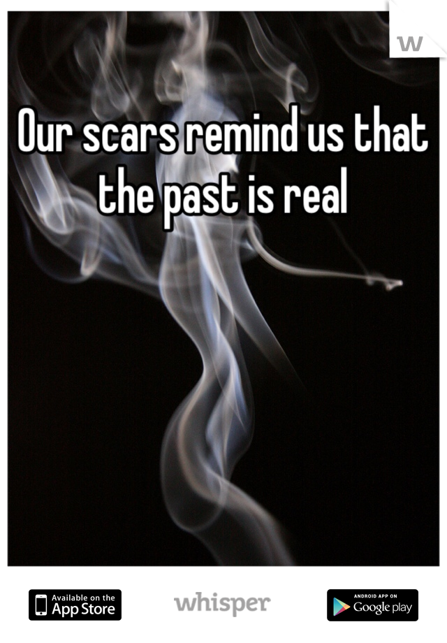 Our scars remind us that the past is real