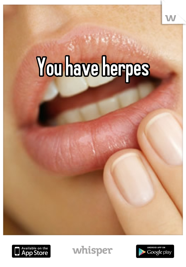 You have herpes