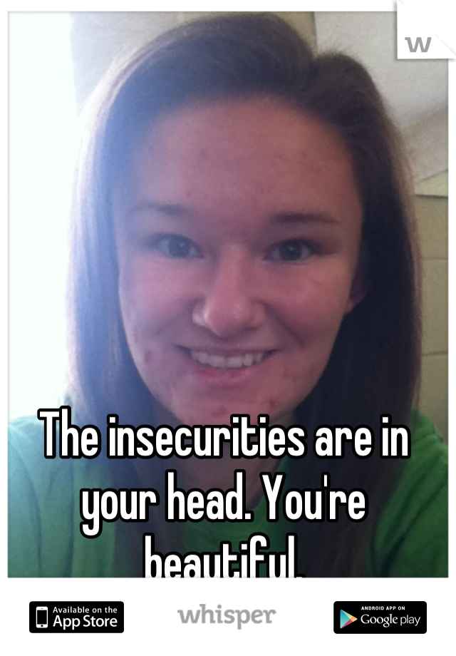 The insecurities are in your head. You're beautiful.
