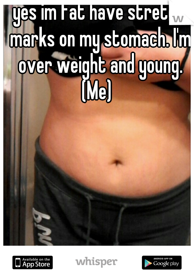 yes im fat have stretch marks on my stomach. I'm over weight and young. (Me)  