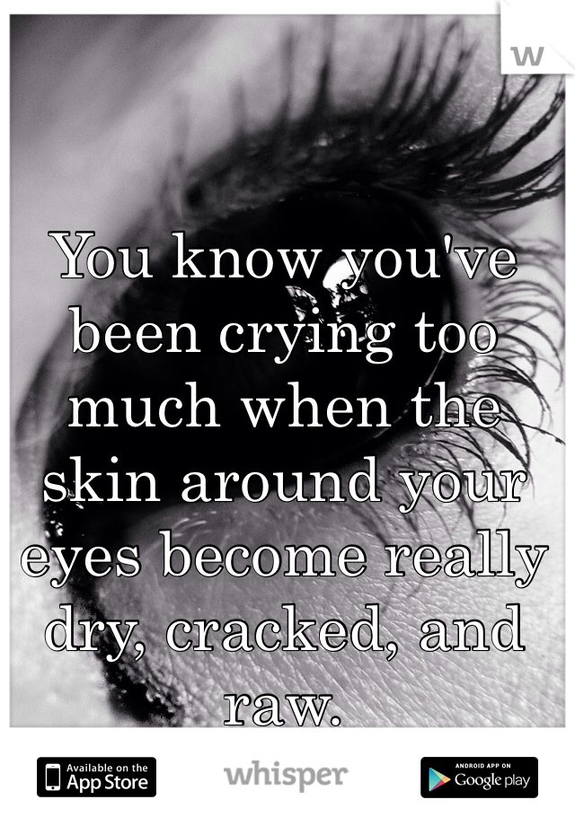 You know you've been crying too much when the skin around your eyes become really dry, cracked, and raw.