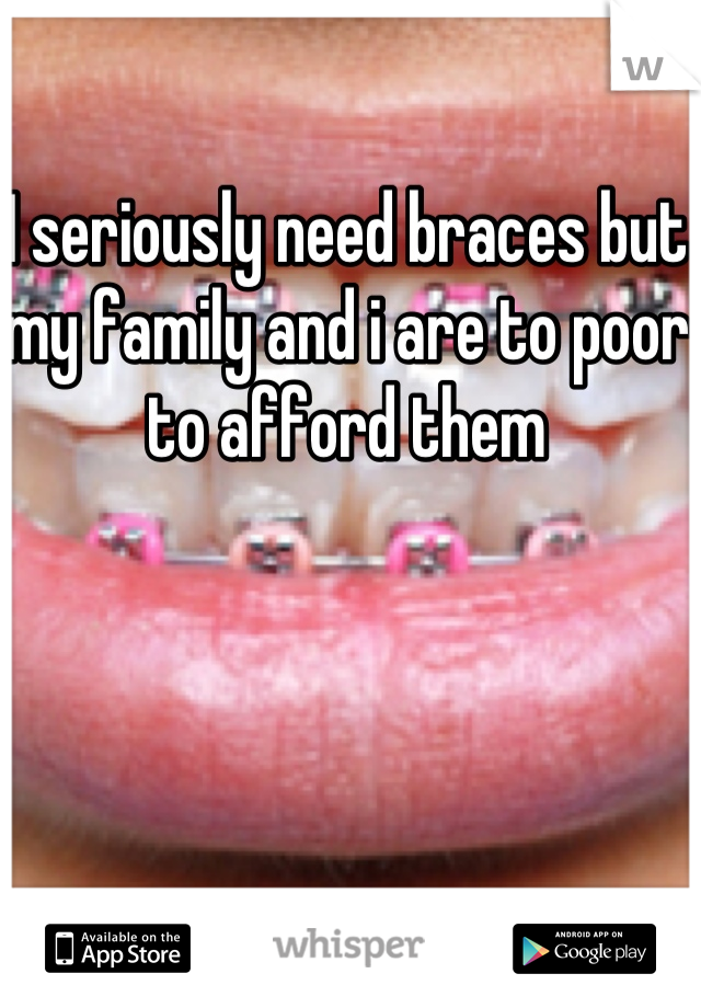 I seriously need braces but my family and i are to poor to afford them