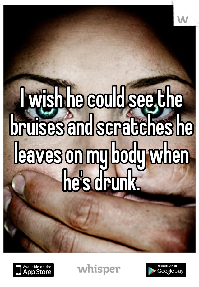 I wish he could see the bruises and scratches he leaves on my body when he's drunk.