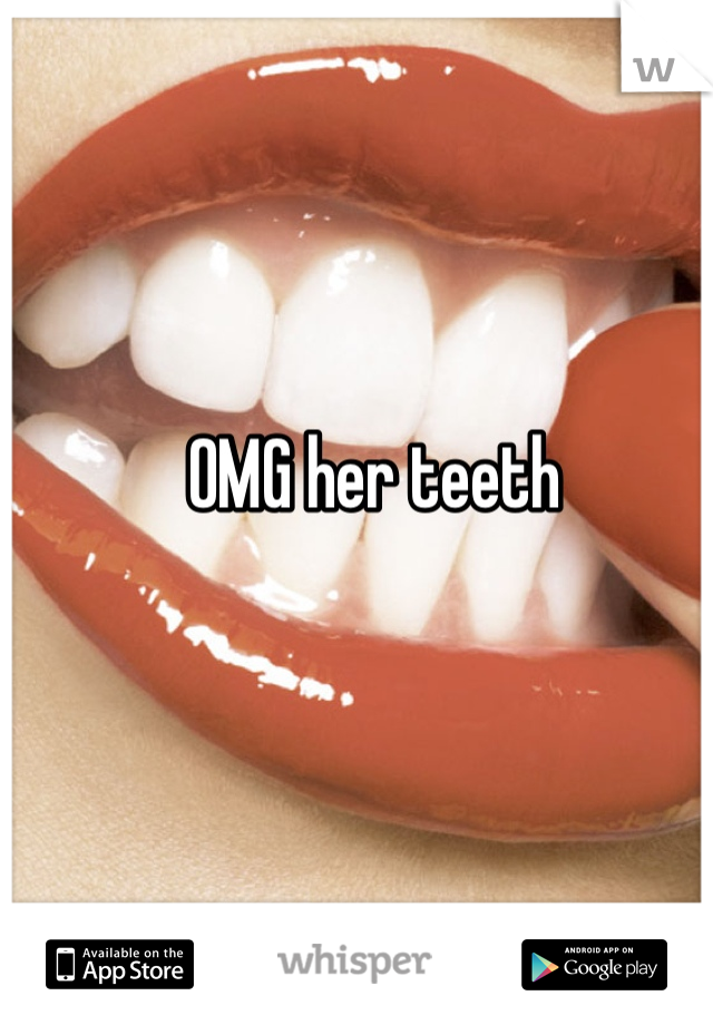 OMG her teeth