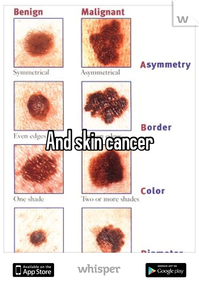 And skin cancer