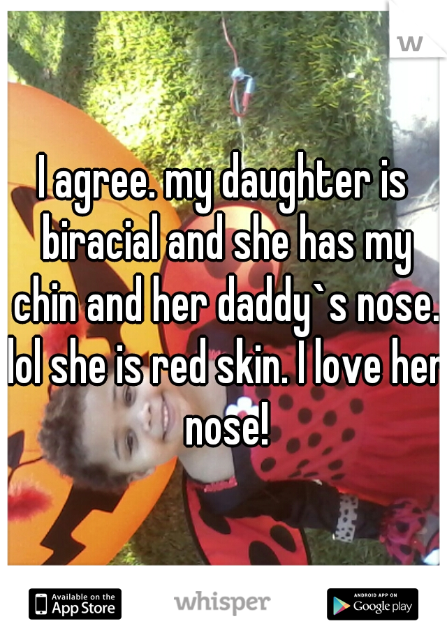 I agree. my daughter is biracial and she has my chin and her daddy`s nose. lol she is red skin. I love her nose!