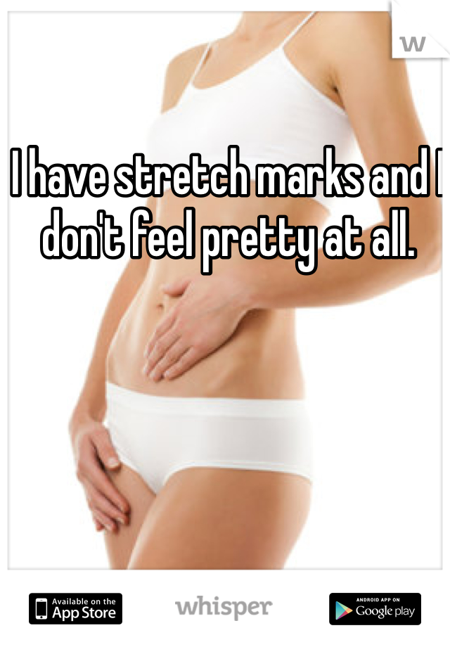 I have stretch marks and I don't feel pretty at all.