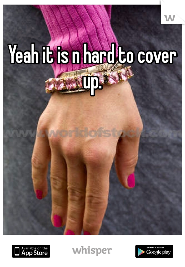 Yeah it is n hard to cover up. 