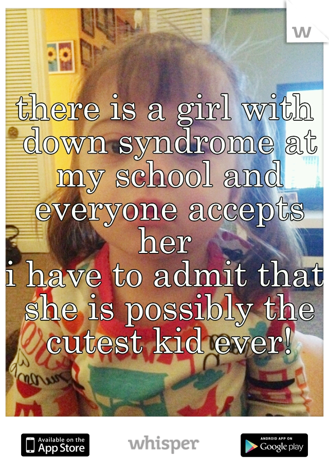 there is a girl with down syndrome at my school and everyone accepts her 
i have to admit that she is possibly the cutest kid ever!