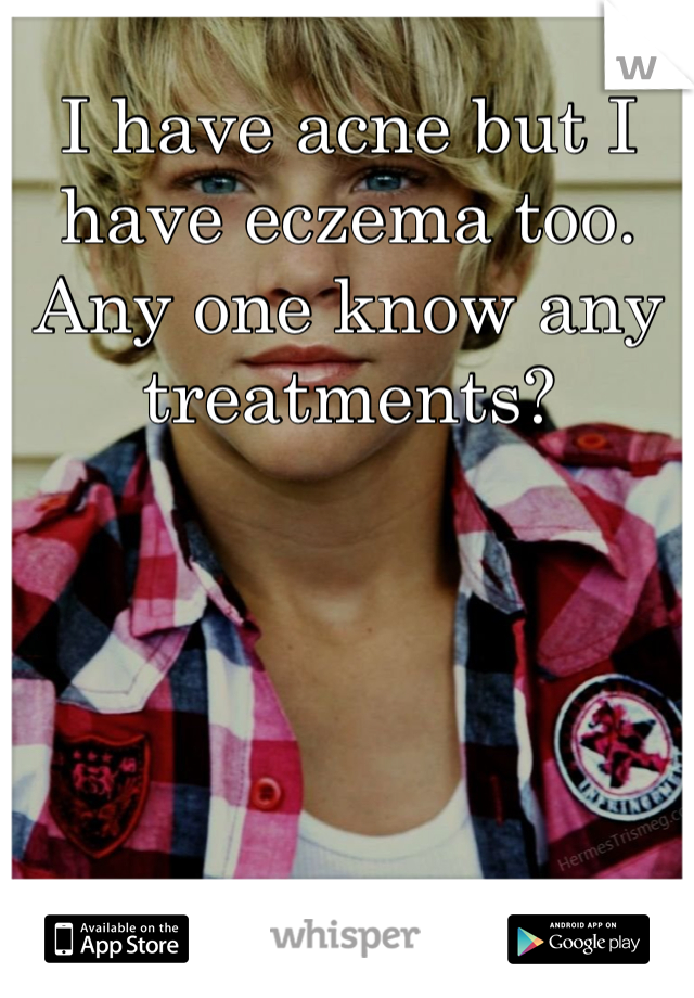 I have acne but I have eczema too. Any one know any treatments?