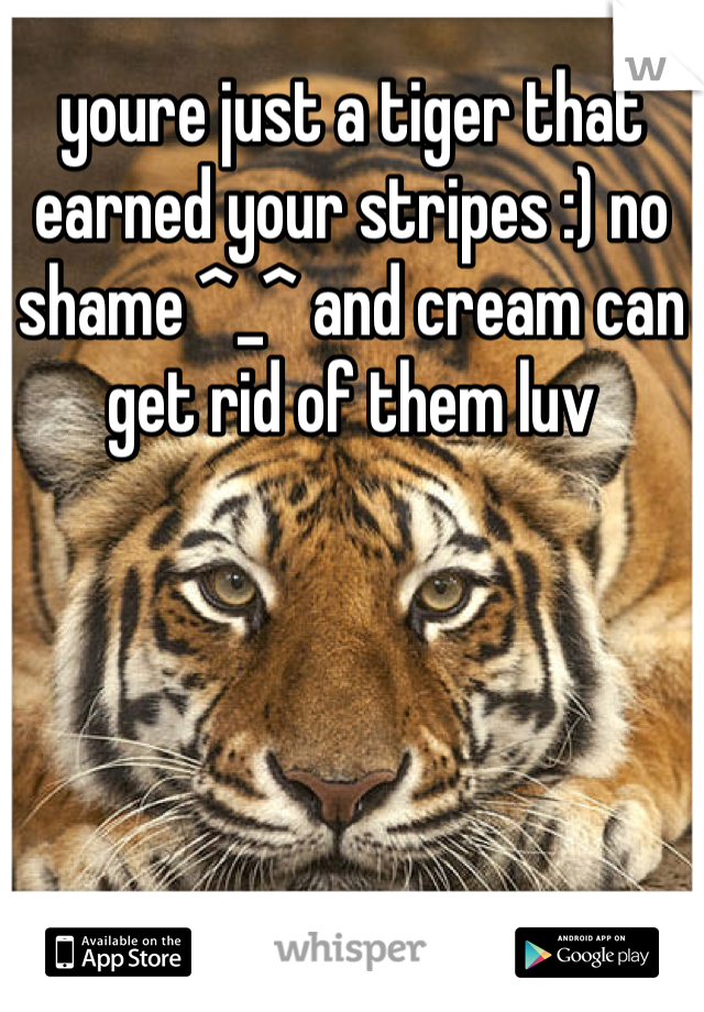 youre just a tiger that earned your stripes :) no shame ^_^ and cream can get rid of them luv