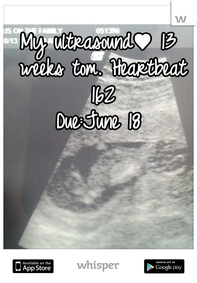 My ultrasound♥ 13 weeks tom. Heartbeat 162





Due:June 18