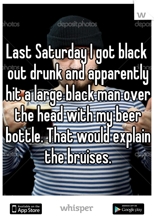 Last Saturday I got black out drunk and apparently hit a large black man over the head with my beer bottle. That would explain the bruises.