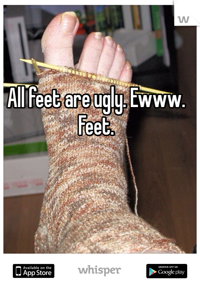 All feet are ugly. Ewww. Feet. 