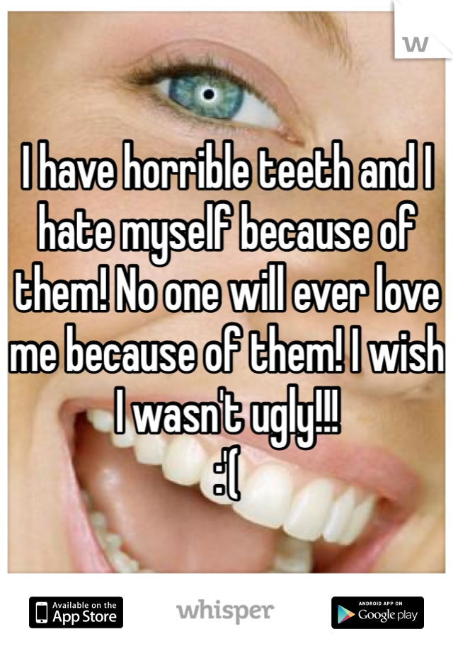 I have horrible teeth and I hate myself because of them! No one will ever love me because of them! I wish I wasn't ugly!!!
:'(