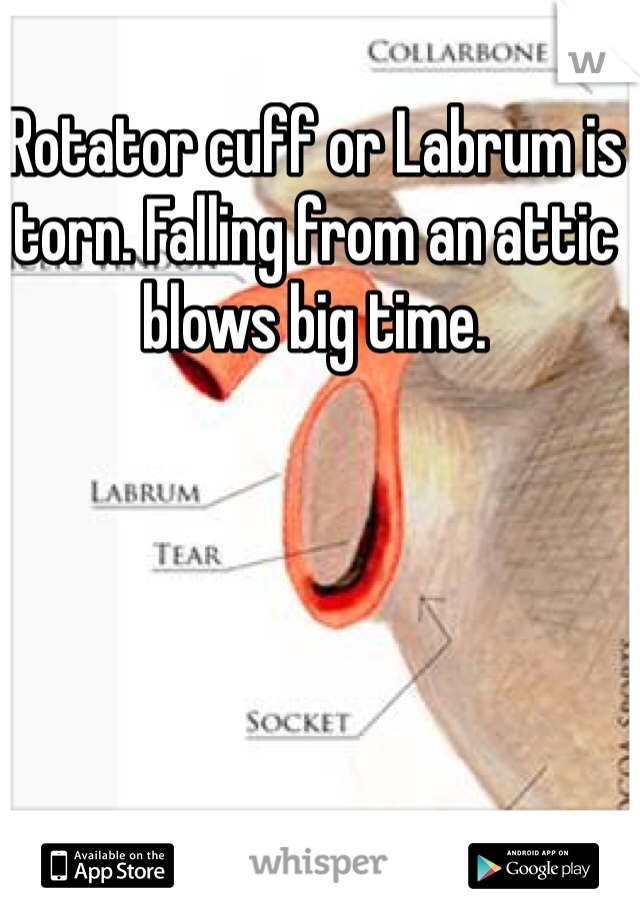 Rotator cuff or Labrum is torn. Falling from an attic blows big time.