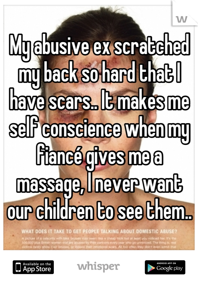My abusive ex scratched my back so hard that I have scars.. It makes me self conscience when my fiancé gives me a massage, I never want our children to see them..