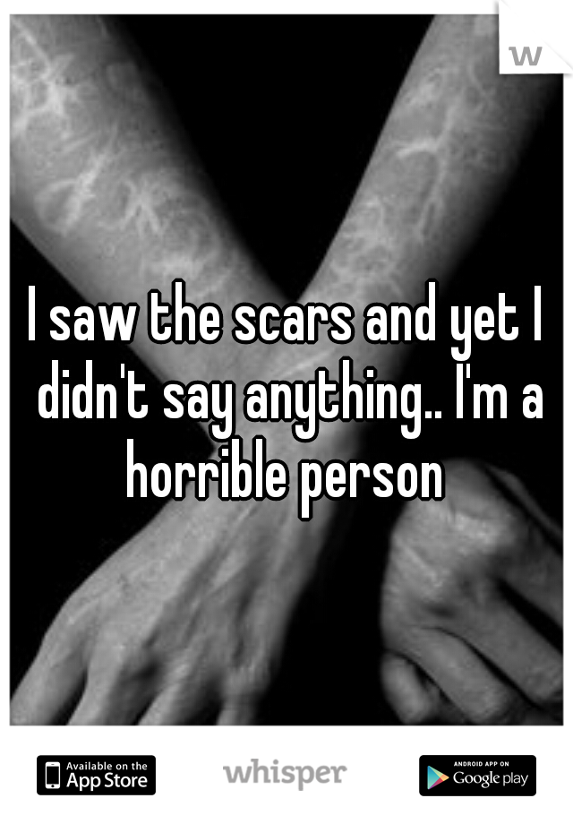 I saw the scars and yet I didn't say anything.. I'm a horrible person 