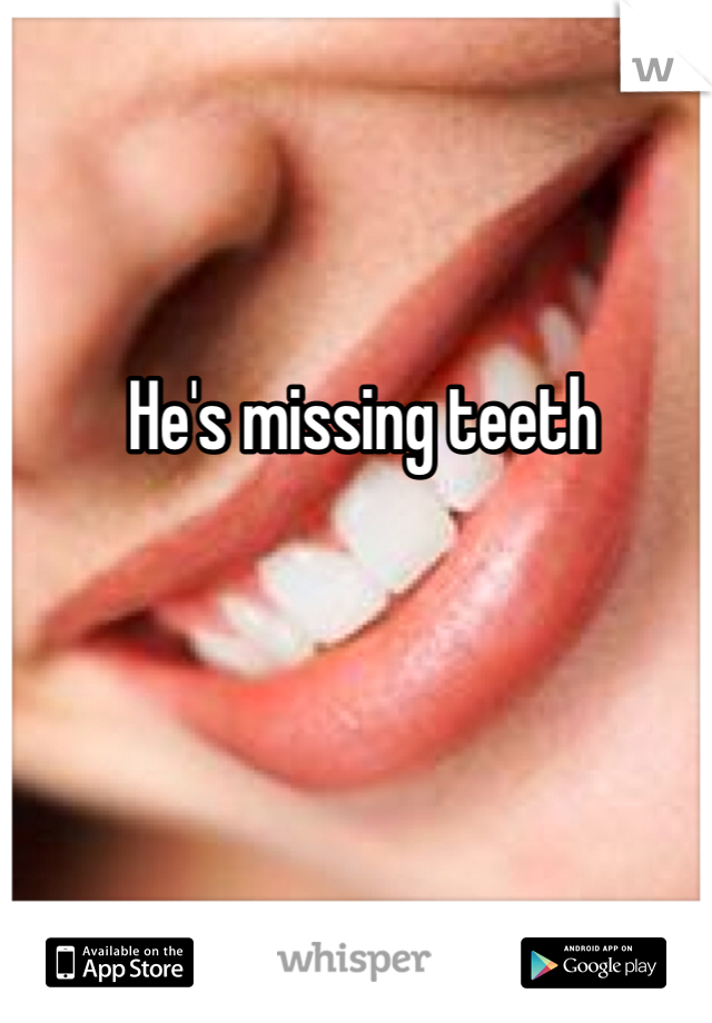 He's missing teeth