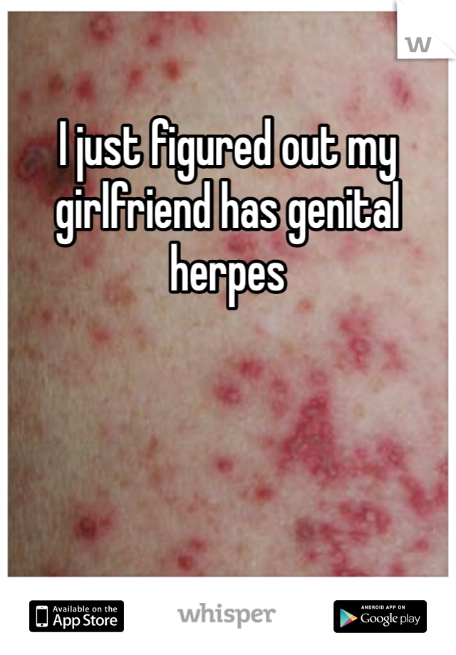 I just figured out my girlfriend has genital herpes