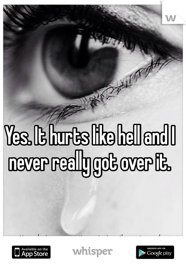 Yes. It hurts like hell and I never really got over it.
