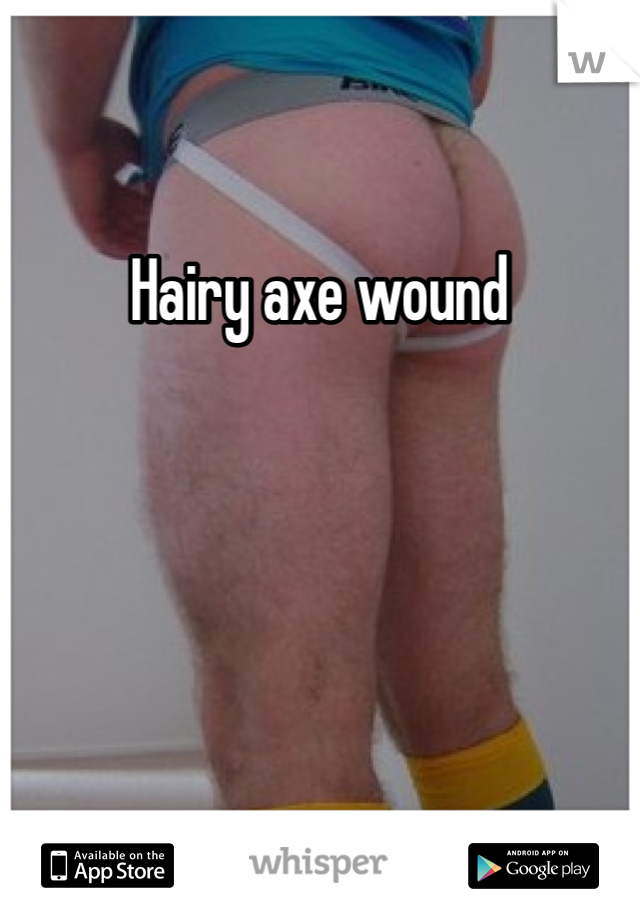 Hairy axe wound