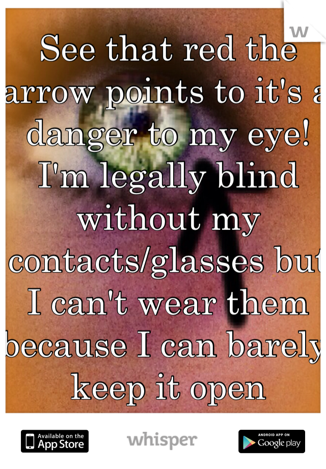 See that red the arrow points to it's a danger to my eye! I'm legally blind without my contacts/glasses but I can't wear them because I can barely keep it open