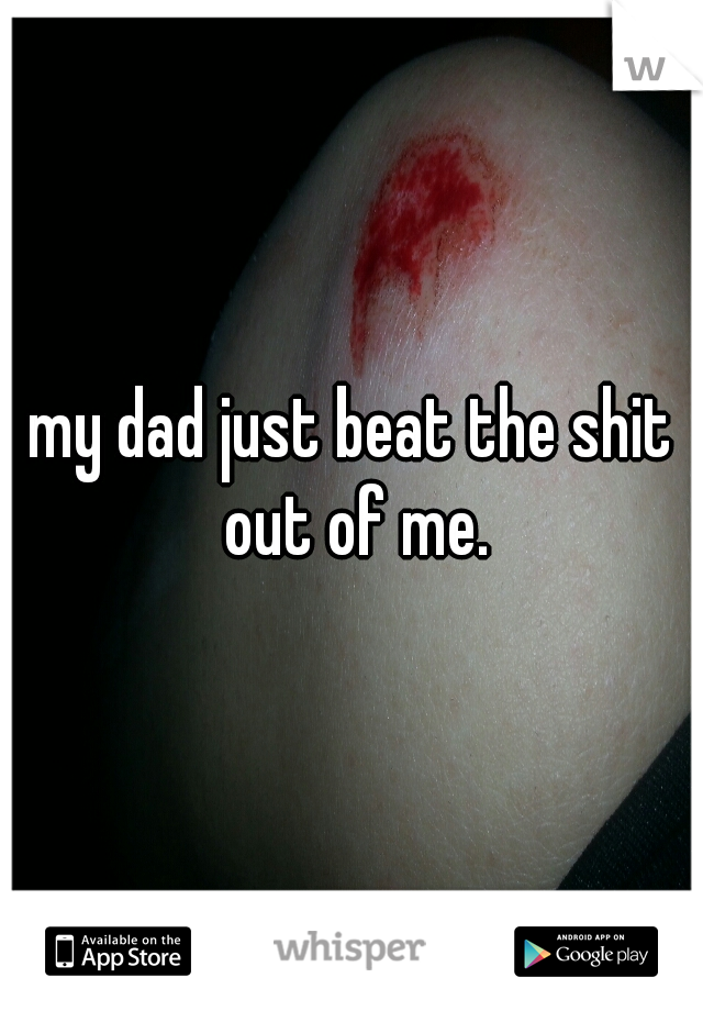 my dad just beat the shit out of me.