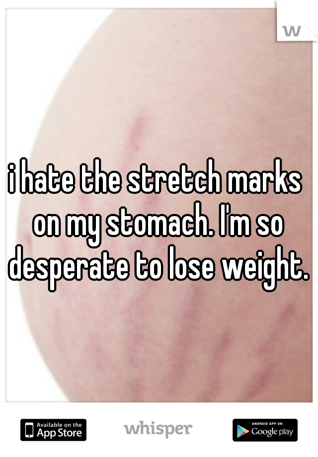 i hate the stretch marks on my stomach. I'm so desperate to lose weight.
