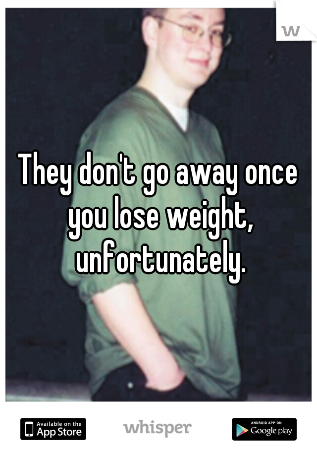 They don't go away once you lose weight, unfortunately.