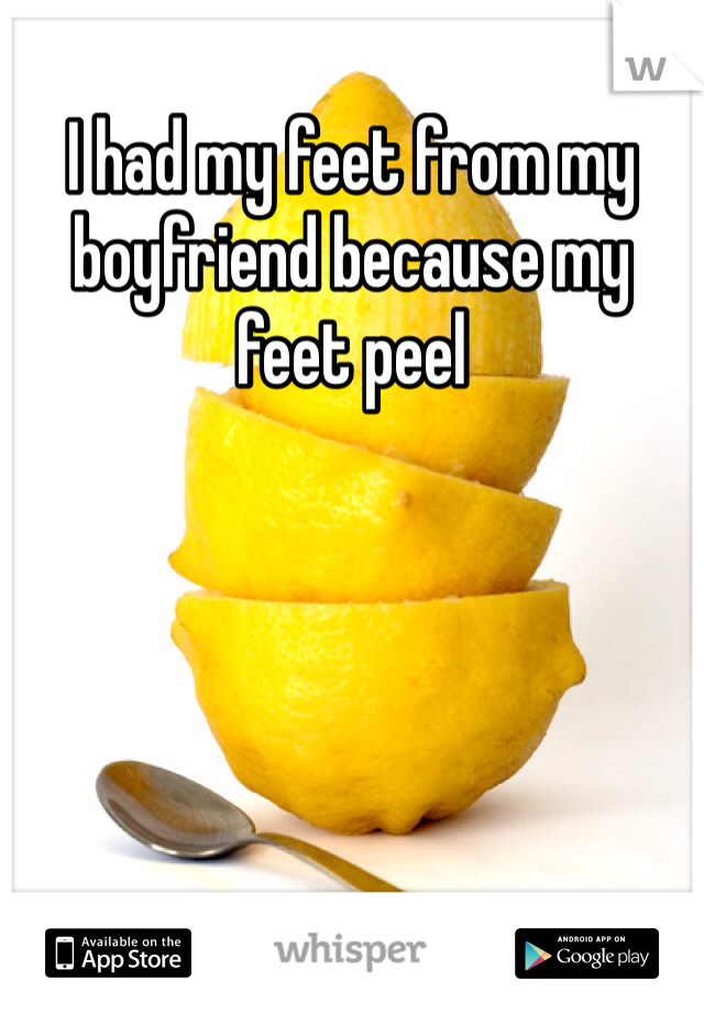 I had my feet from my boyfriend because my feet peel