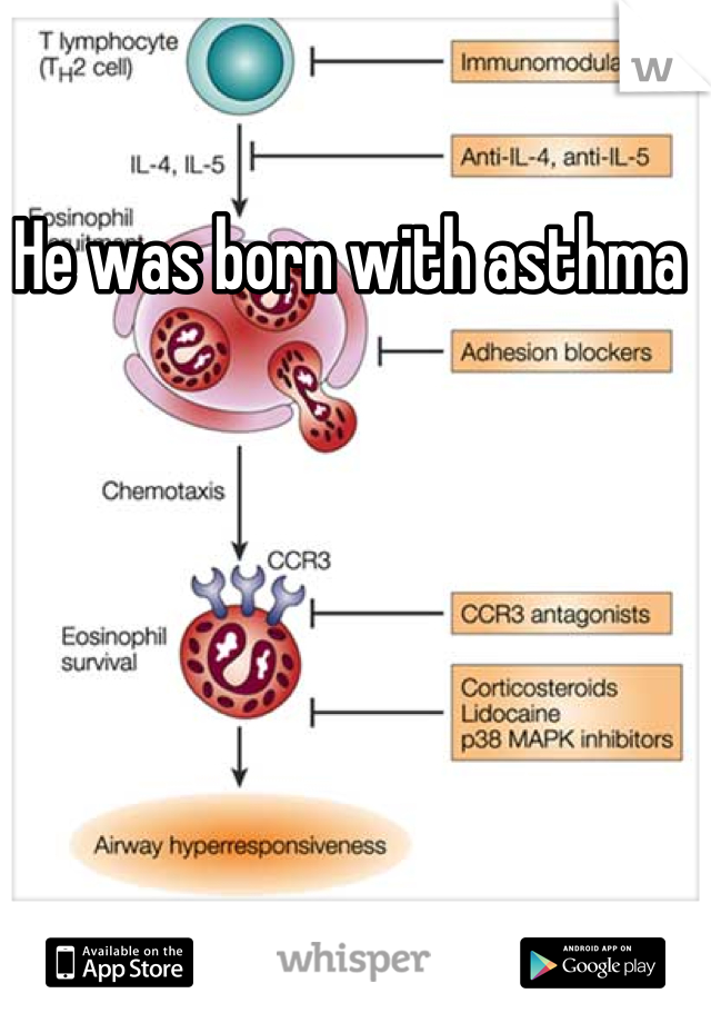 He was born with asthma 