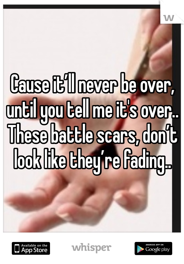 Cause it’ll never be over, until you tell me it's over..
These battle scars, don’t look like they’re fading..