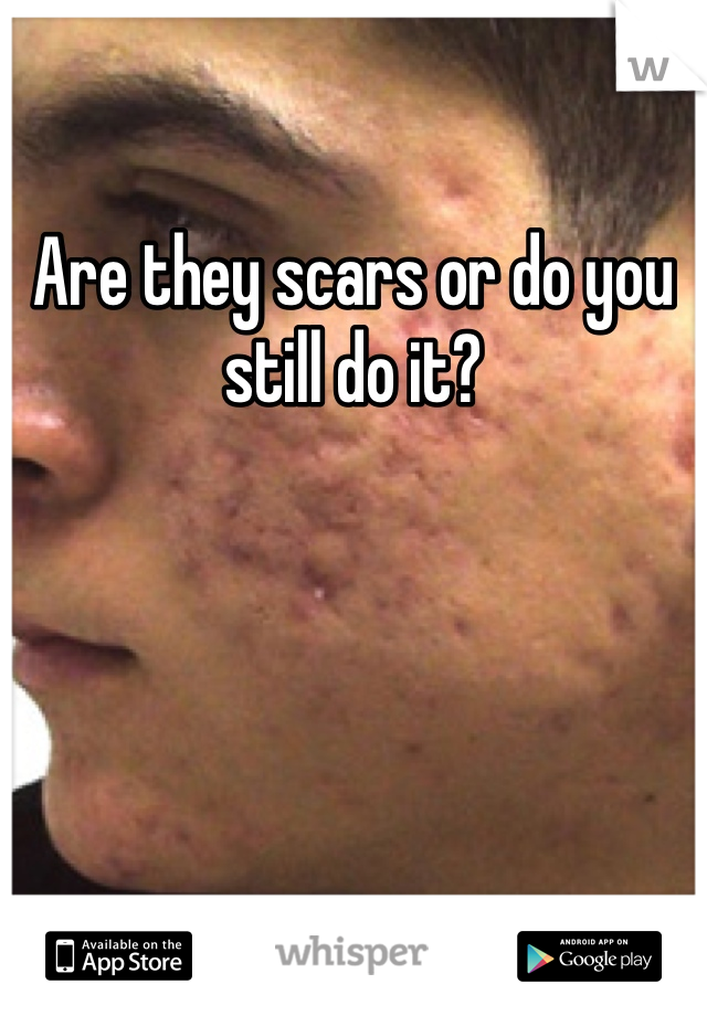 Are they scars or do you still do it?