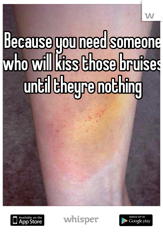 Because you need someone who will kiss those bruises until theyre nothing