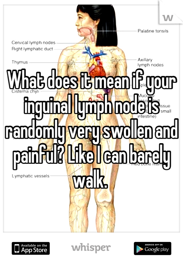 What does it mean if your inguinal lymph node is randomly very swollen and painful? Like I can barely walk. 