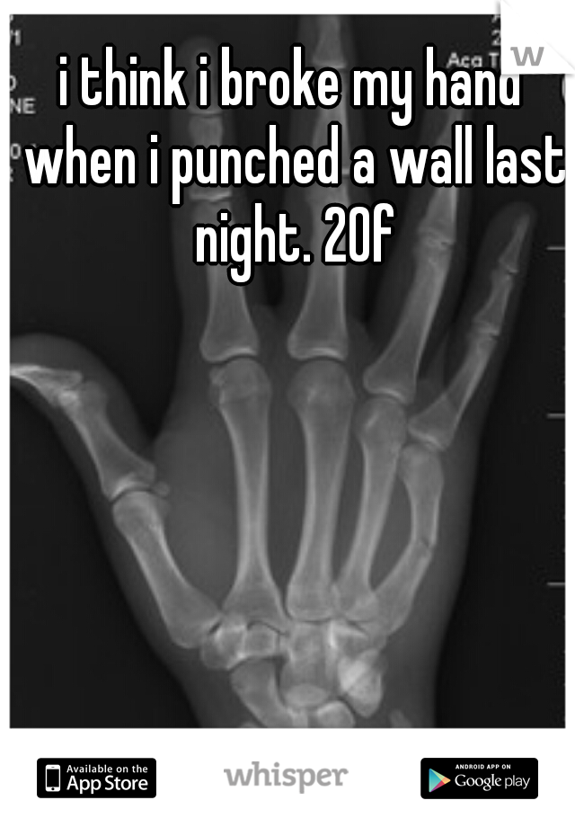 i think i broke my hand when i punched a wall last night. 20f