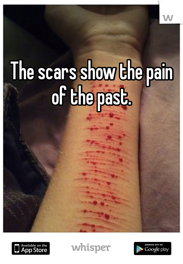 The scars show the pain of the past.