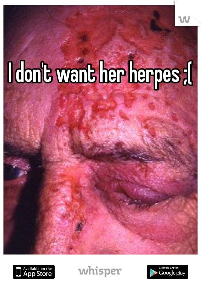 I don't want her herpes ;(