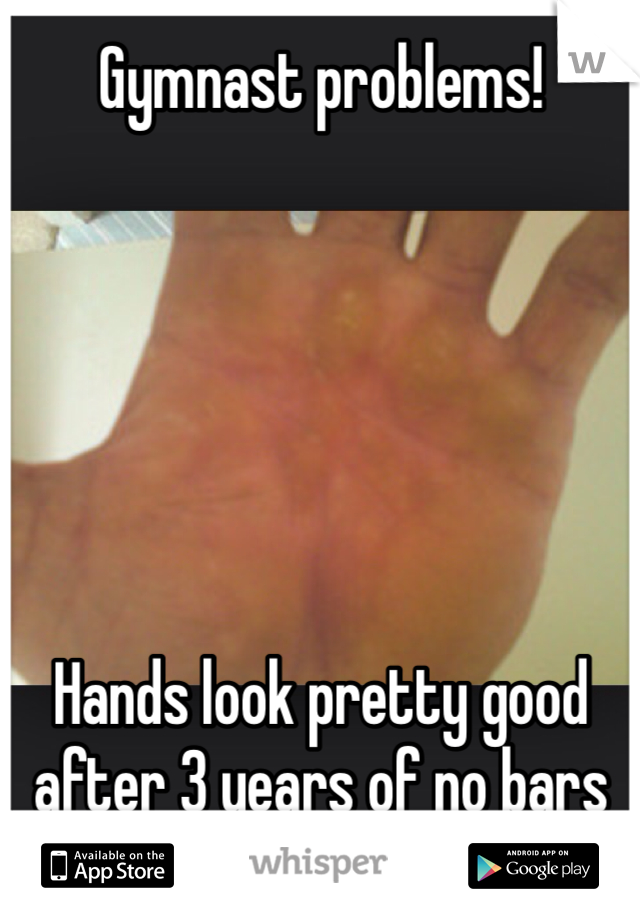 Gymnast problems! 






Hands look pretty good after 3 years of no bars 