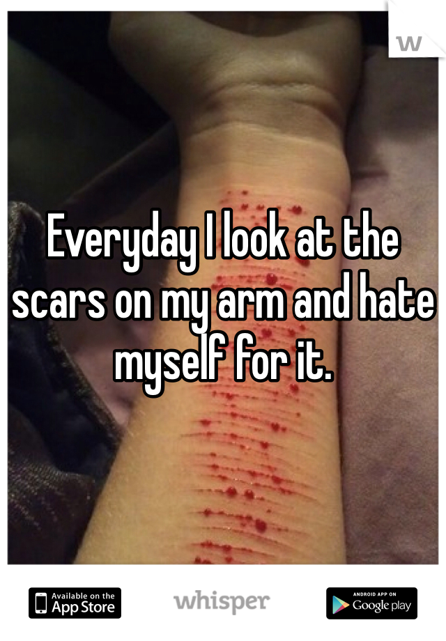 Everyday I look at the scars on my arm and hate myself for it. 