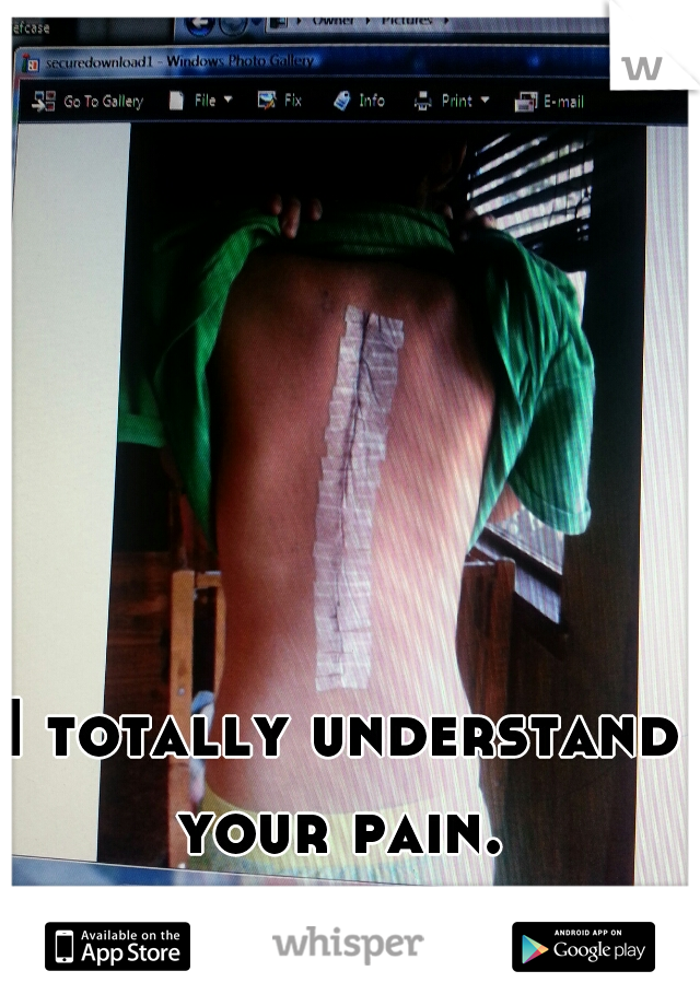 I totally understand your pain. 


this is my bck